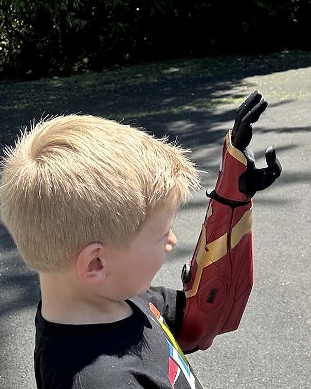 Né sans main gauche, il tient enfin son guidon à deux mains