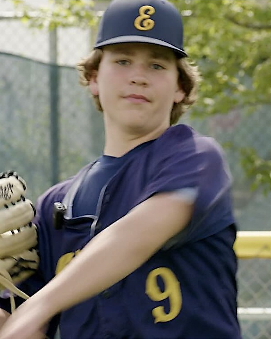Pour qu'il rejoue au baseball, son rein greffé a changé de côté
